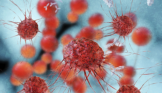 Cancer epidemiology: new trends and risks, and what they mean for insurance